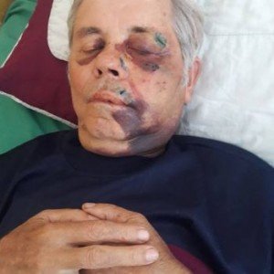 На Закарпатті невідомі жорстоко побили і пограбували священика